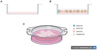 Organoids in Lung Cancer Management